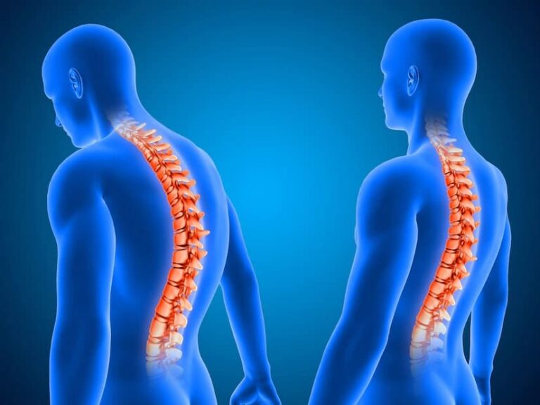 Tudo o que você precisa saber sobre a coluna vertebral